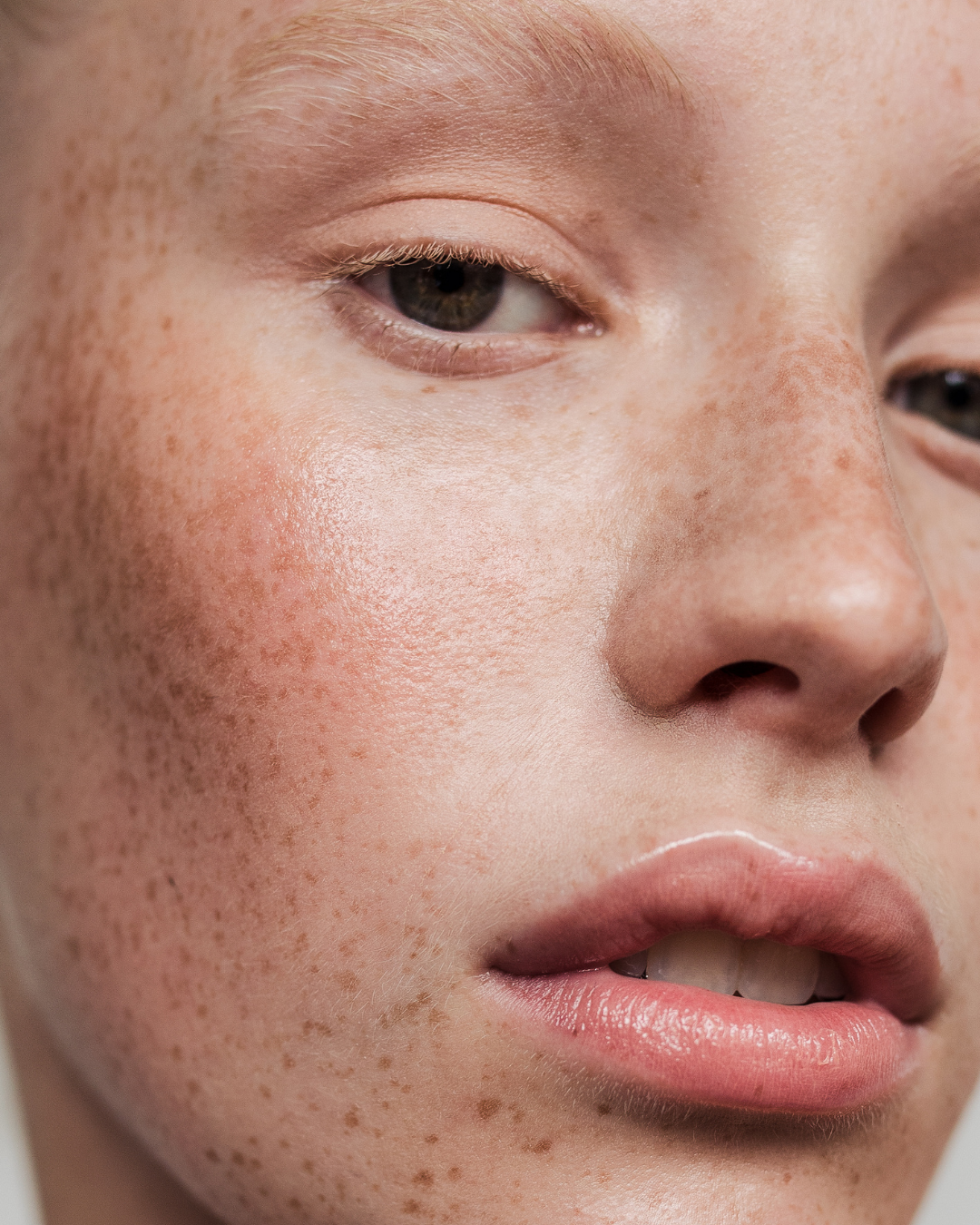 The Truth About the Skin Barrier (And Why You Should Protect It)