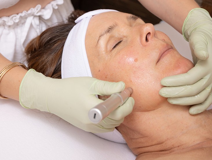 Nano Infusion: The Gentle First Step Toward Collagen Renewal